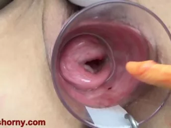 Asian Cervix Tearing Up With Lollipop Fuck Stick And Japanese Chopsticks